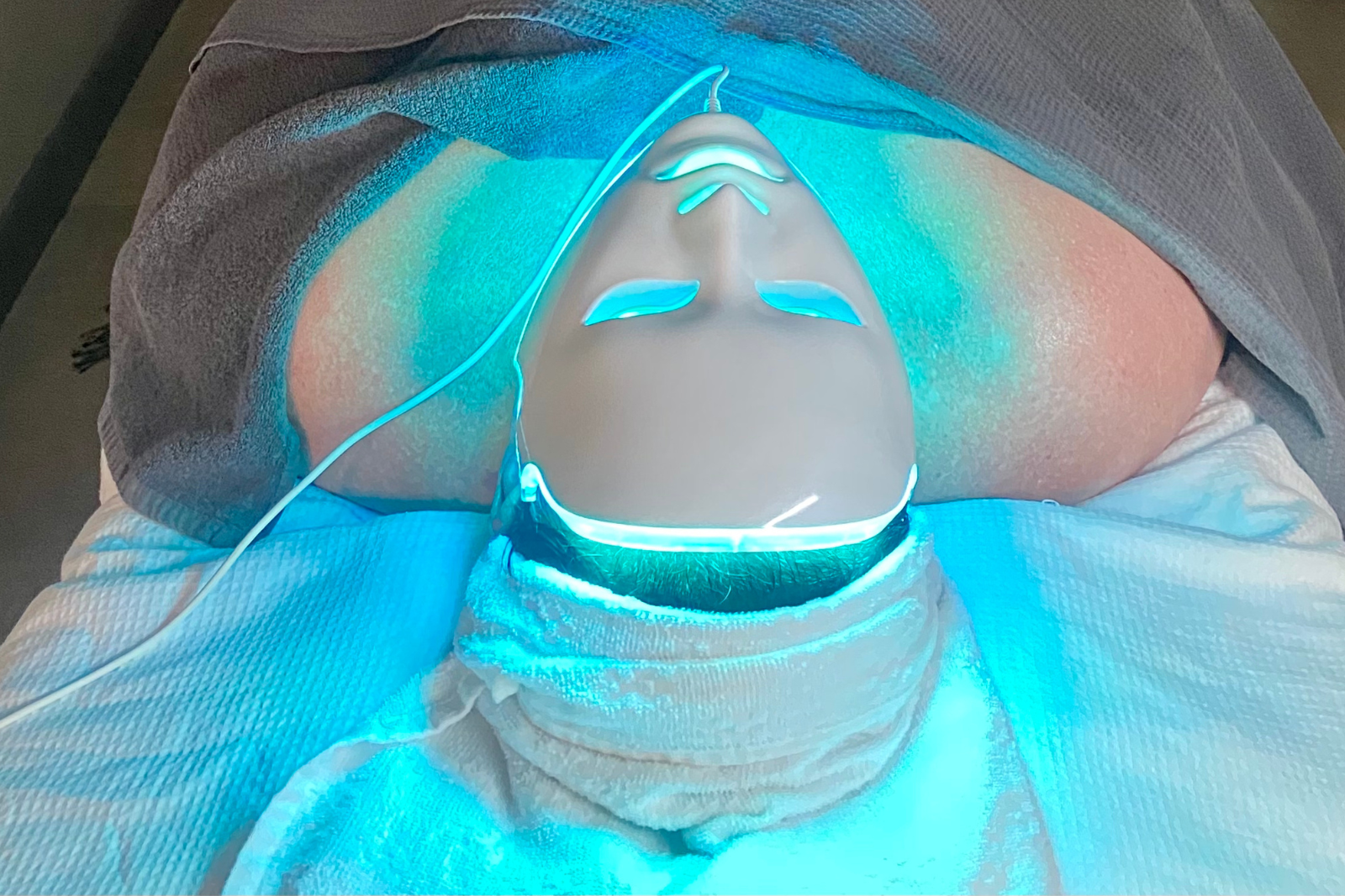 deesse led facials