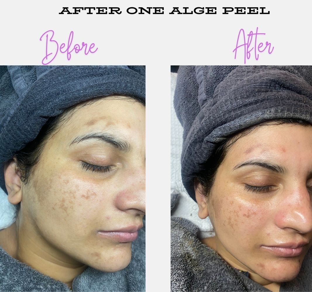 DÃ‰CAAR Algae Peel