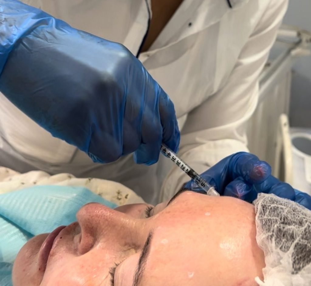 Aesthetics treatments