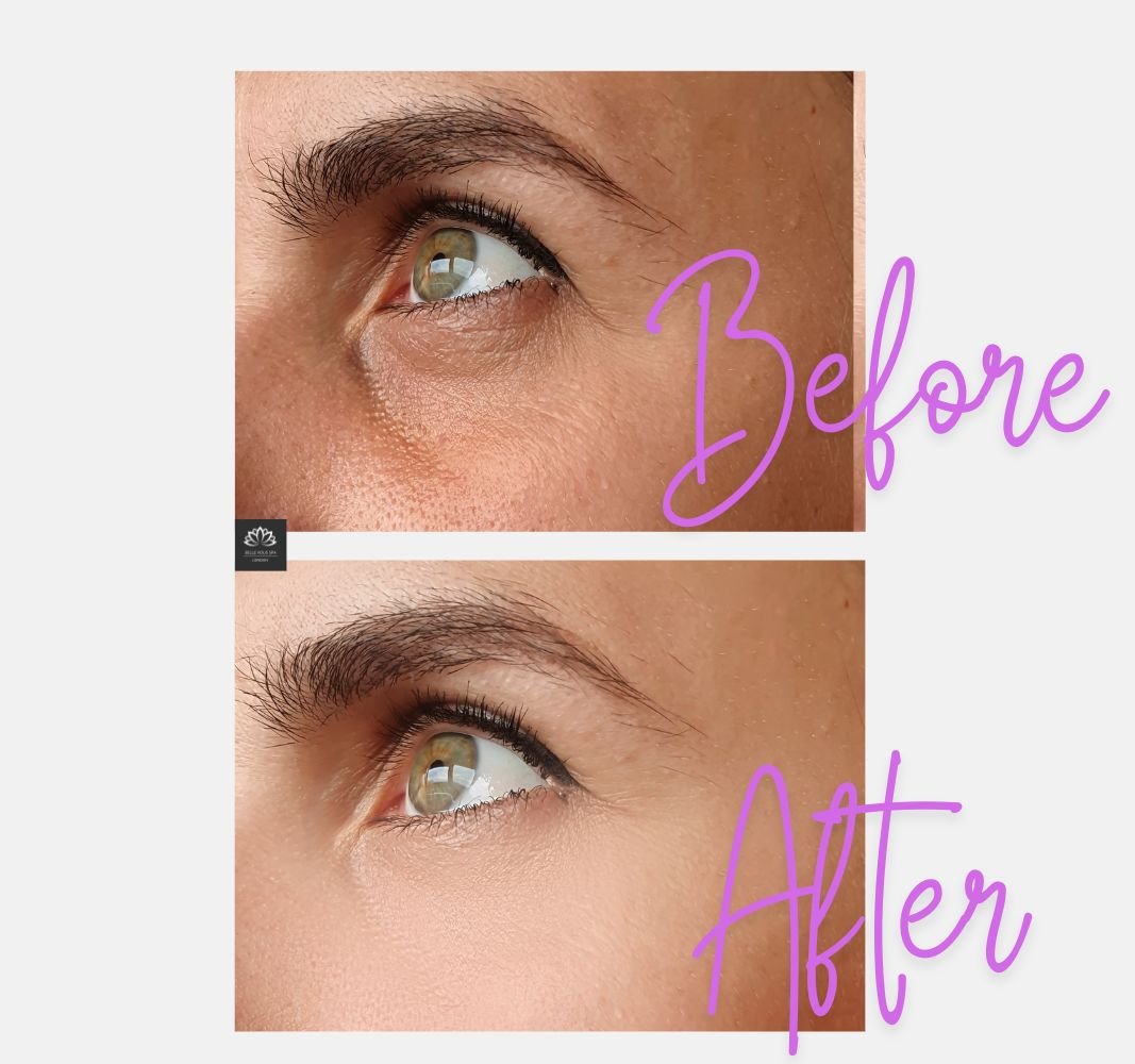 Dermaren Lumi Eyes