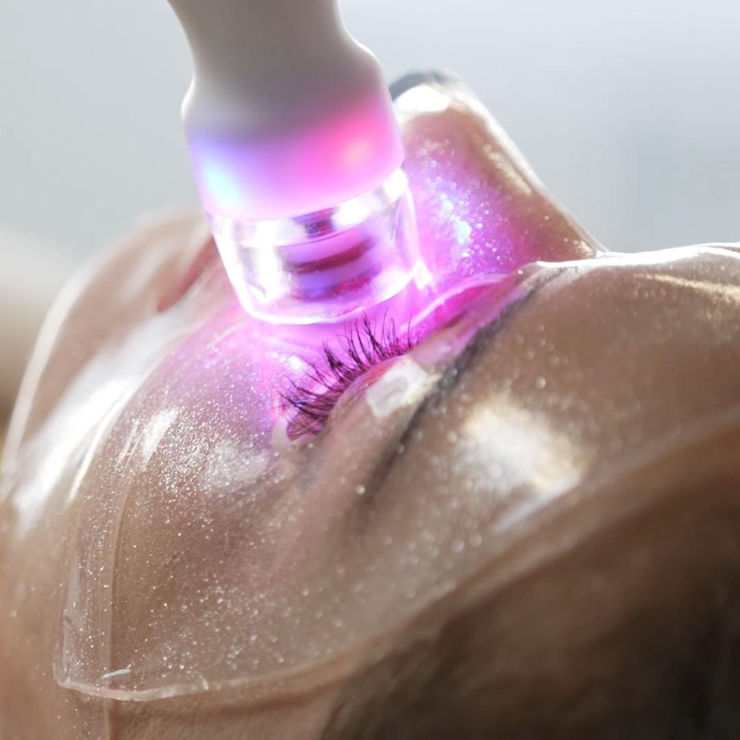 Microdermabrasion Facials