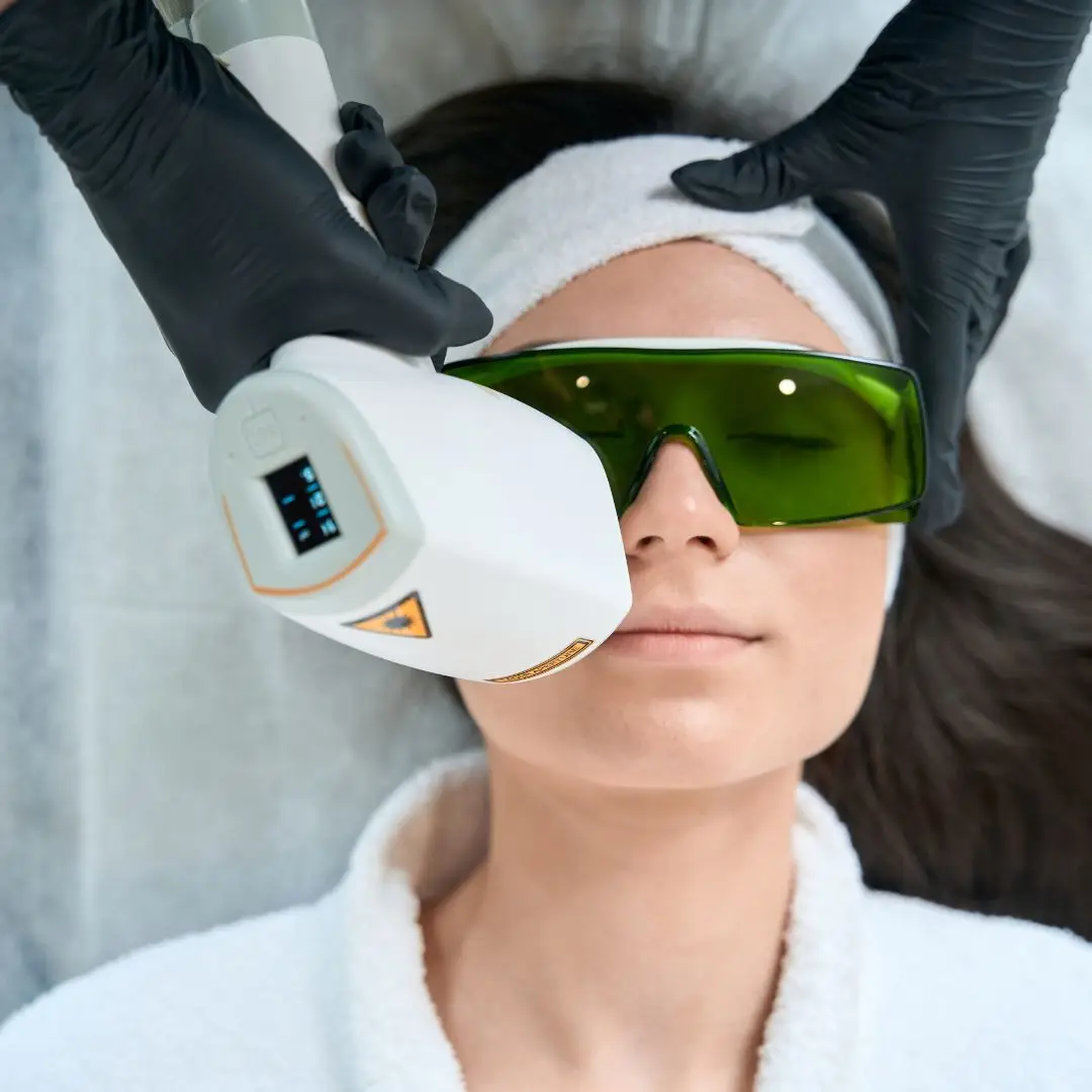 laser hair removal
