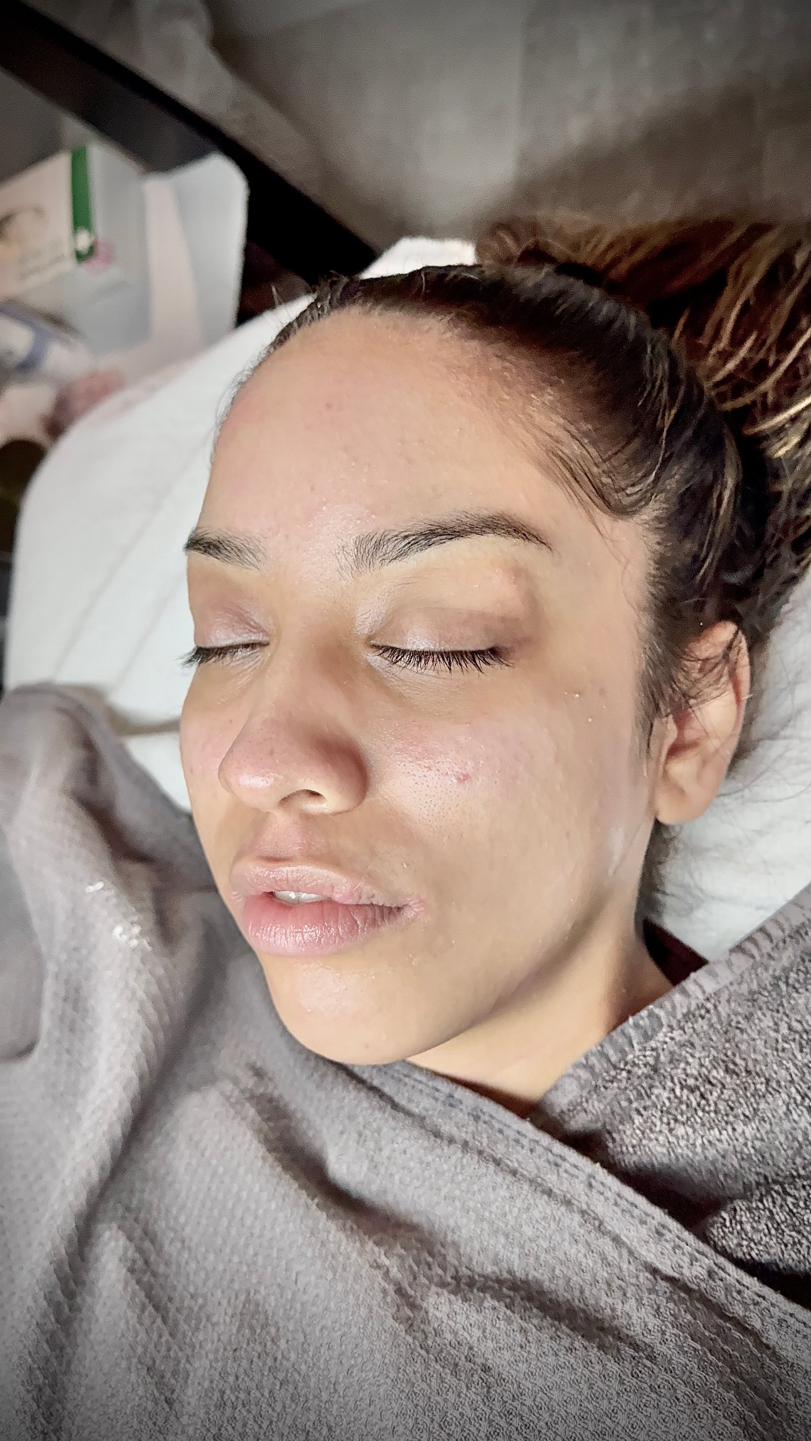 glowing skin on clients face