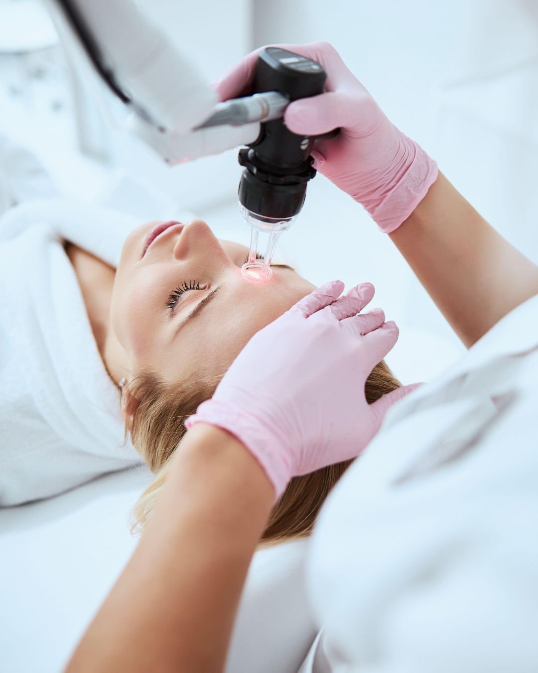 laser facial