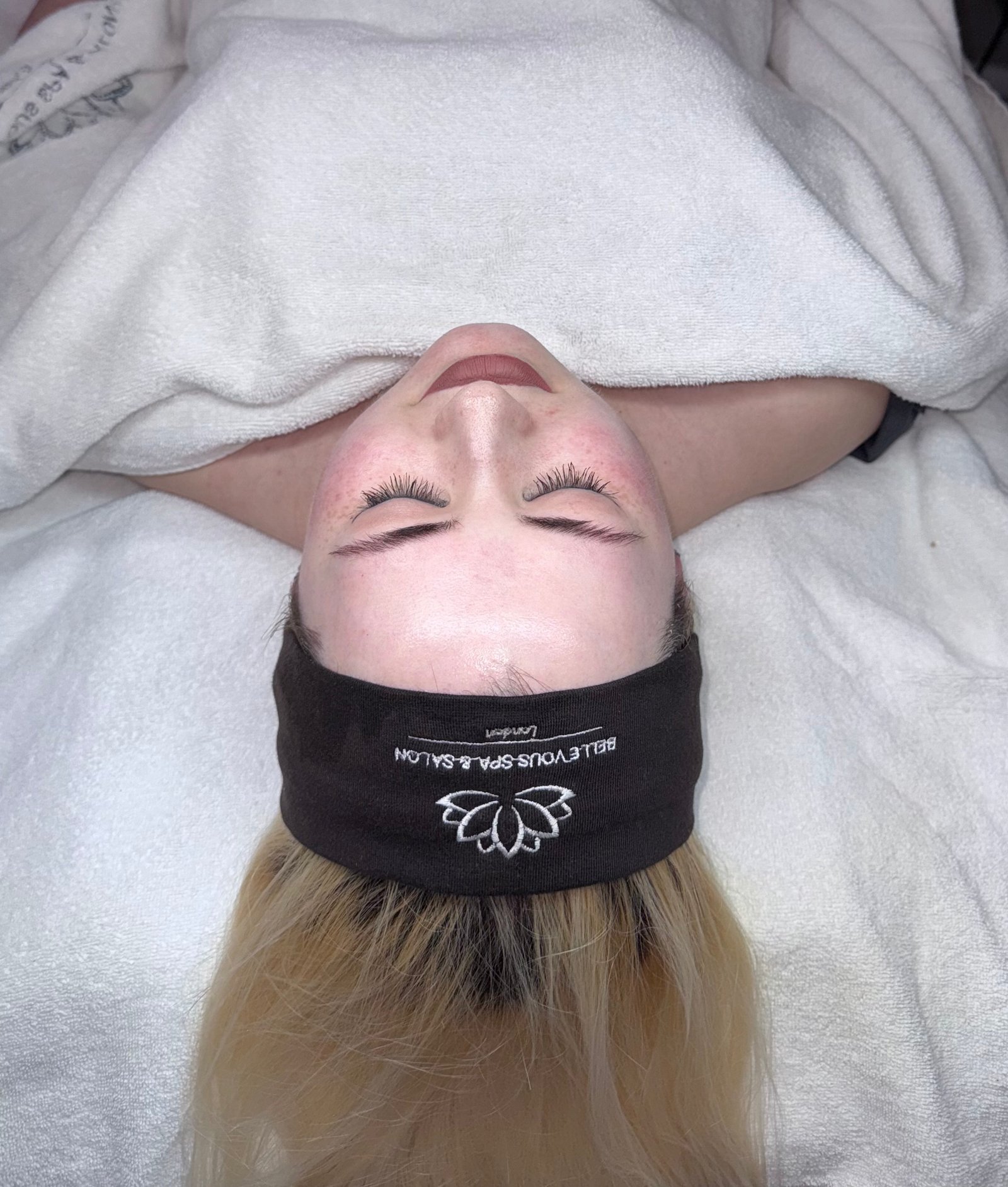 Laser Skin Rejuvenation